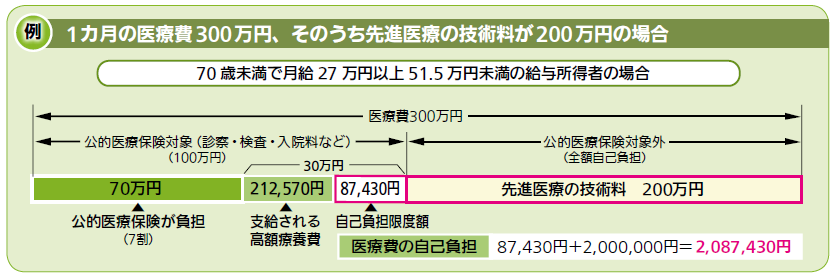 先進医療自己負担例